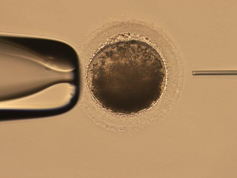 microscopic image of intracytoplasmic sperm injection