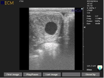 black and white ultrasound image