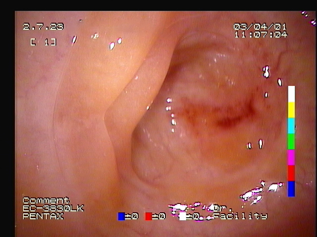 hysteroscopic image of a horse's uterus