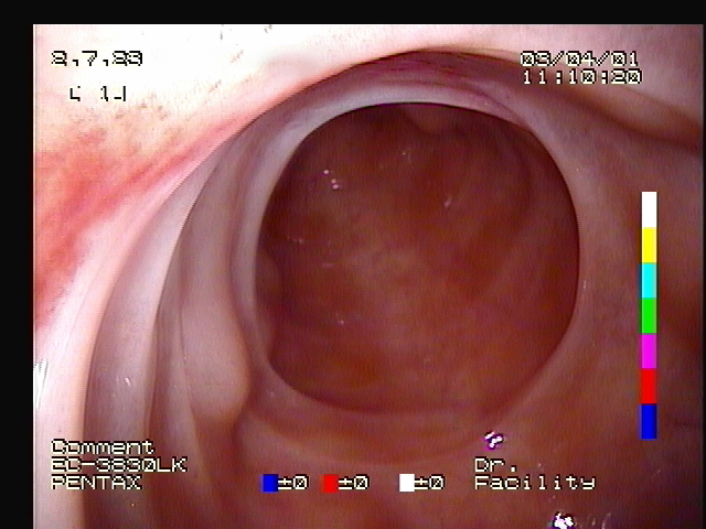 hysteroscopic image of a horse's uterus