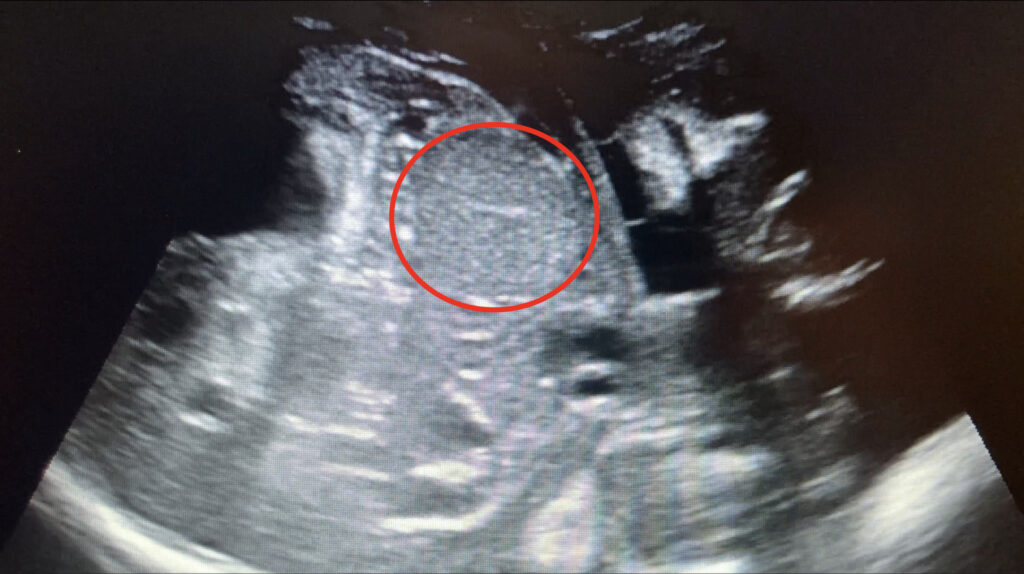 ultrasound image of an equine male gonad