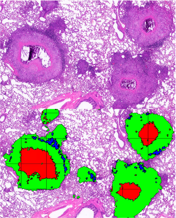 pink microscopic image taken using Visiopharm technology