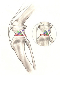 Canine Cruciate Ligament Injury - Veterinary Teaching Hospital