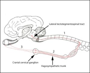 diagram of Horner's syndrome